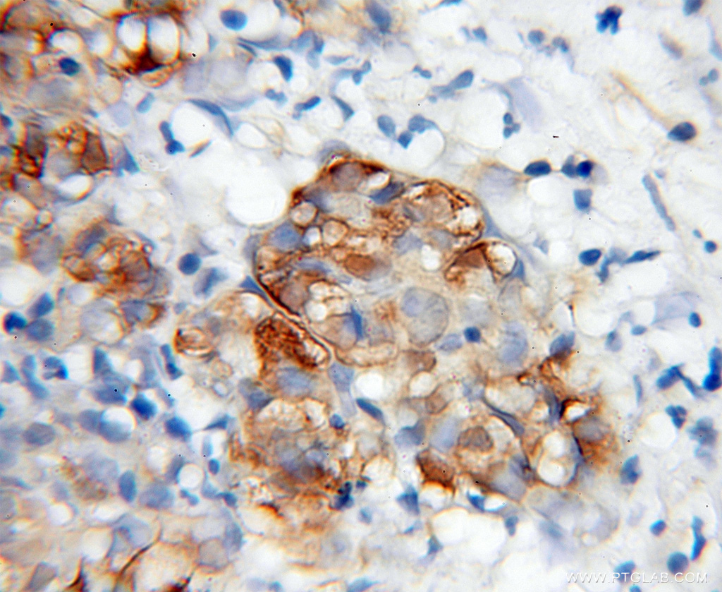 WWP2 Polyclonal antibody