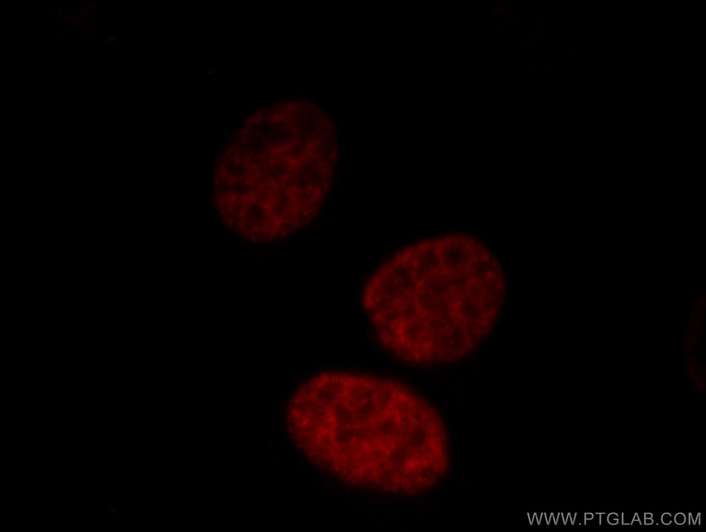 MATR3 Polyclonal antibody