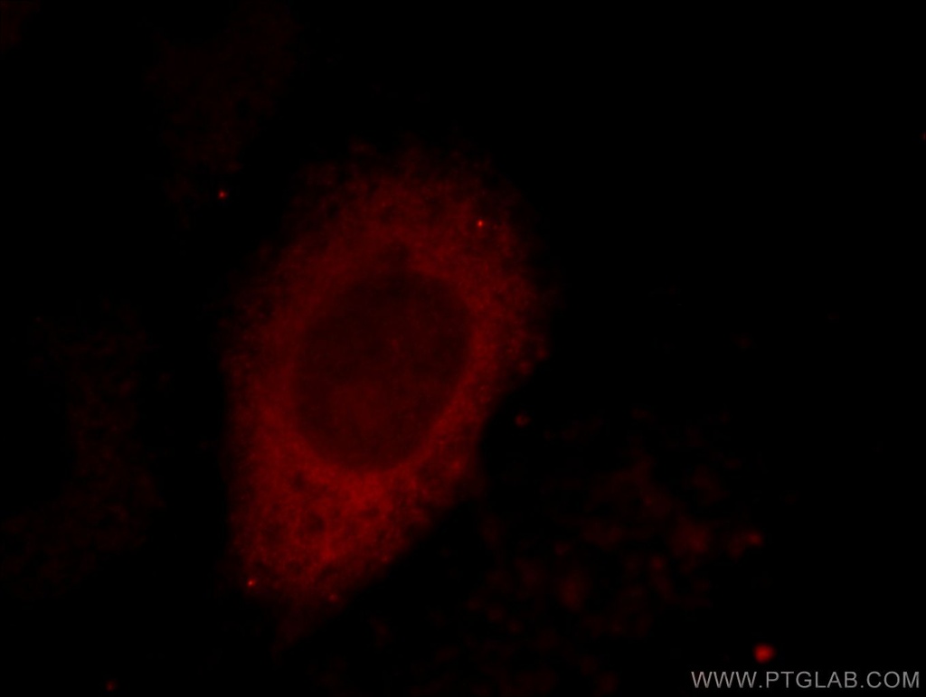 CTRP1 Polyclonal antibody