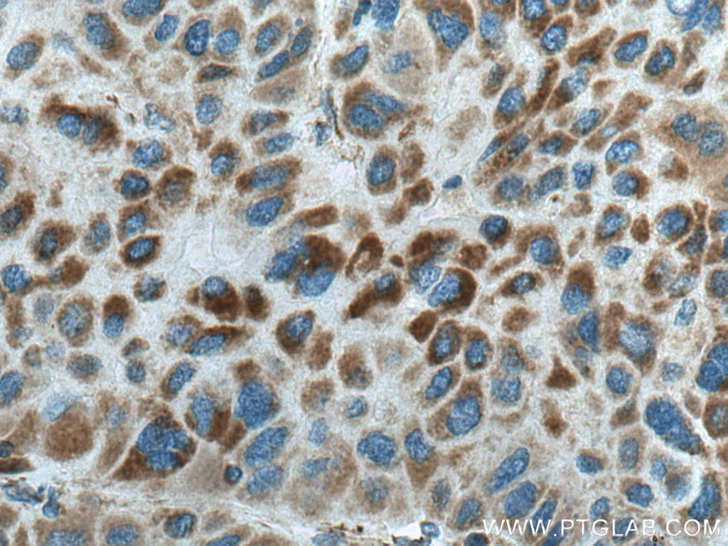 CPOX Polyclonal antibody