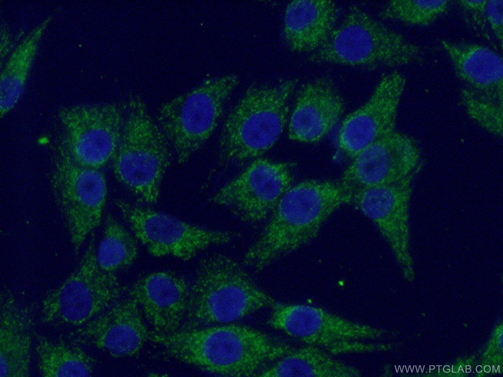SSBP1 Polyclonal antibody