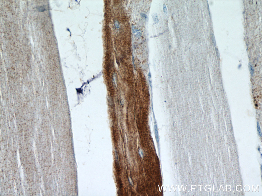 MARCH5 Polyclonal antibody