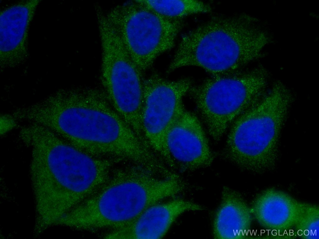 PEPD Polyclonal antibody