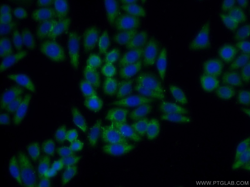 BMP7 Polyclonal antibody