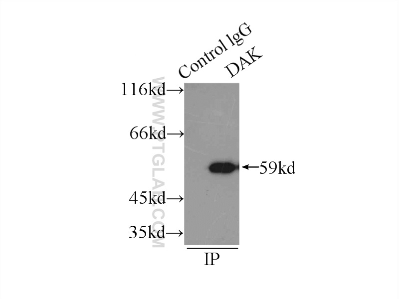 DAK Polyclonal antibody