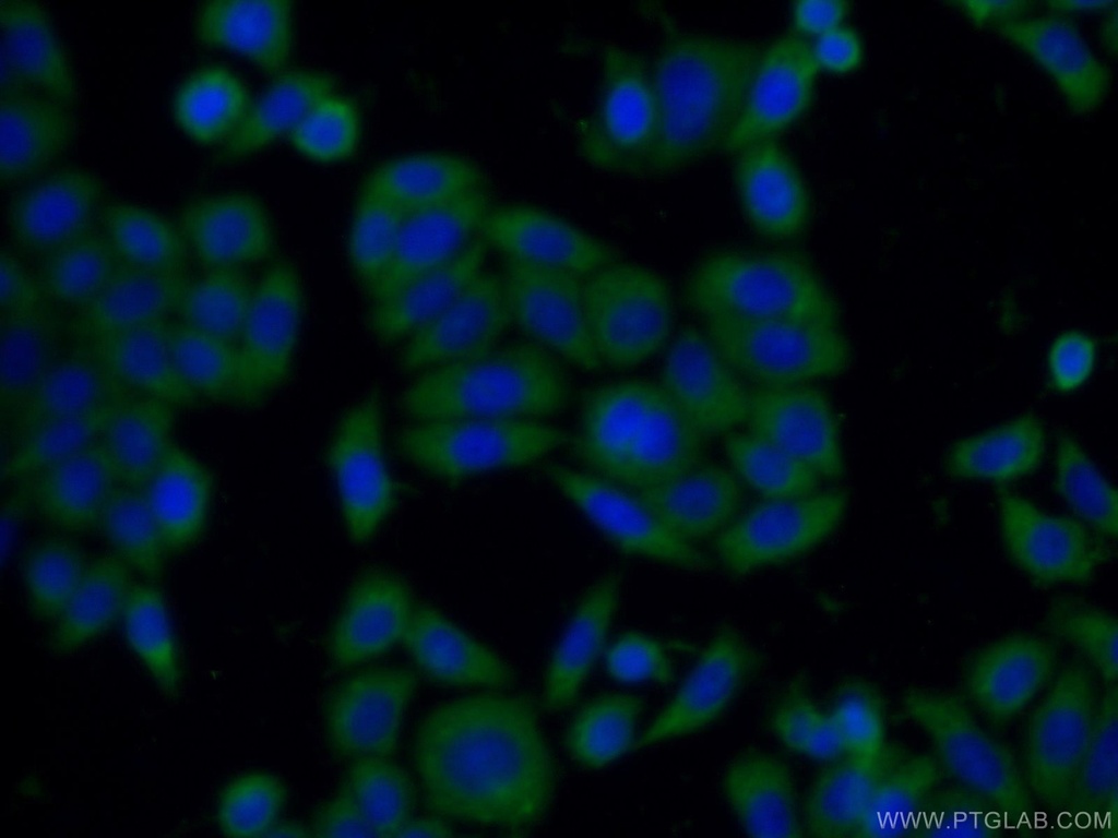SH2B1 Polyclonal antibody