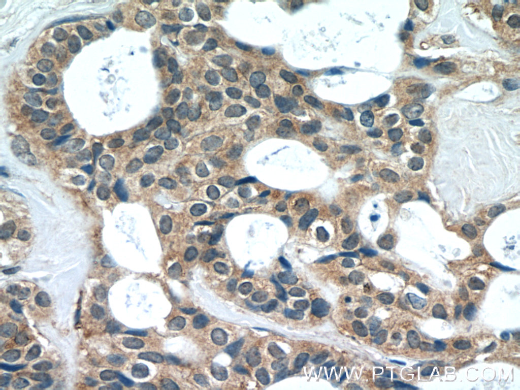 EIF4E2 Polyclonal antibody