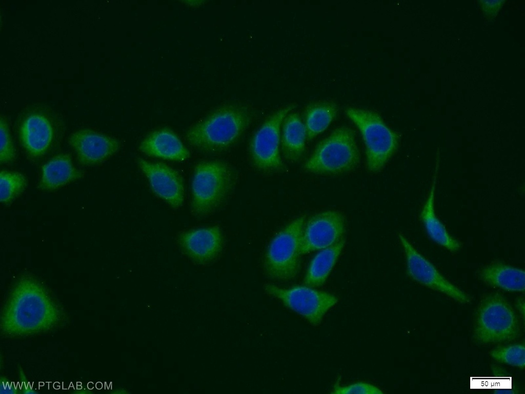 MVK Polyclonal antibody