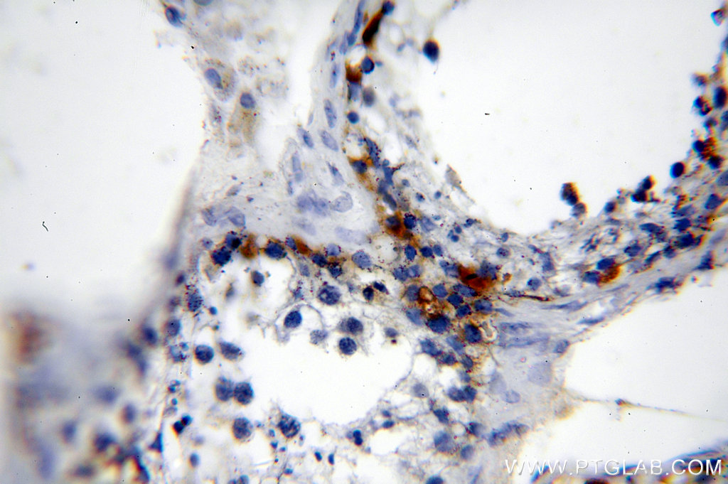 MAGEA1 Polyclonal antibody