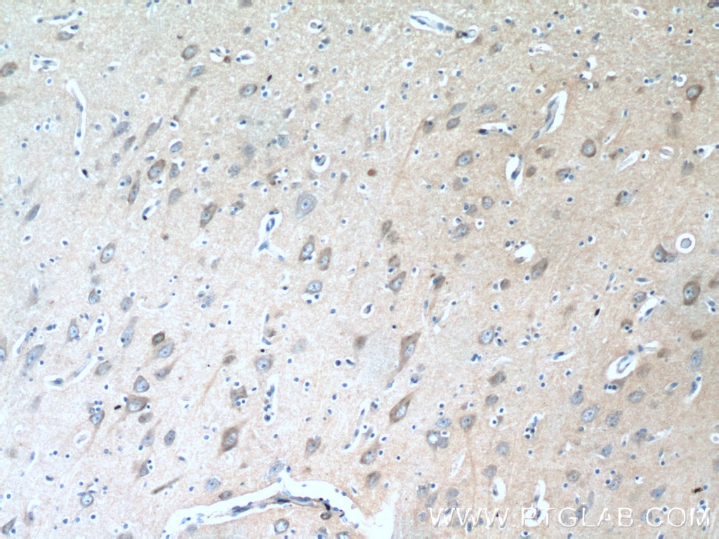 TAGLN3 Polyclonal antibody