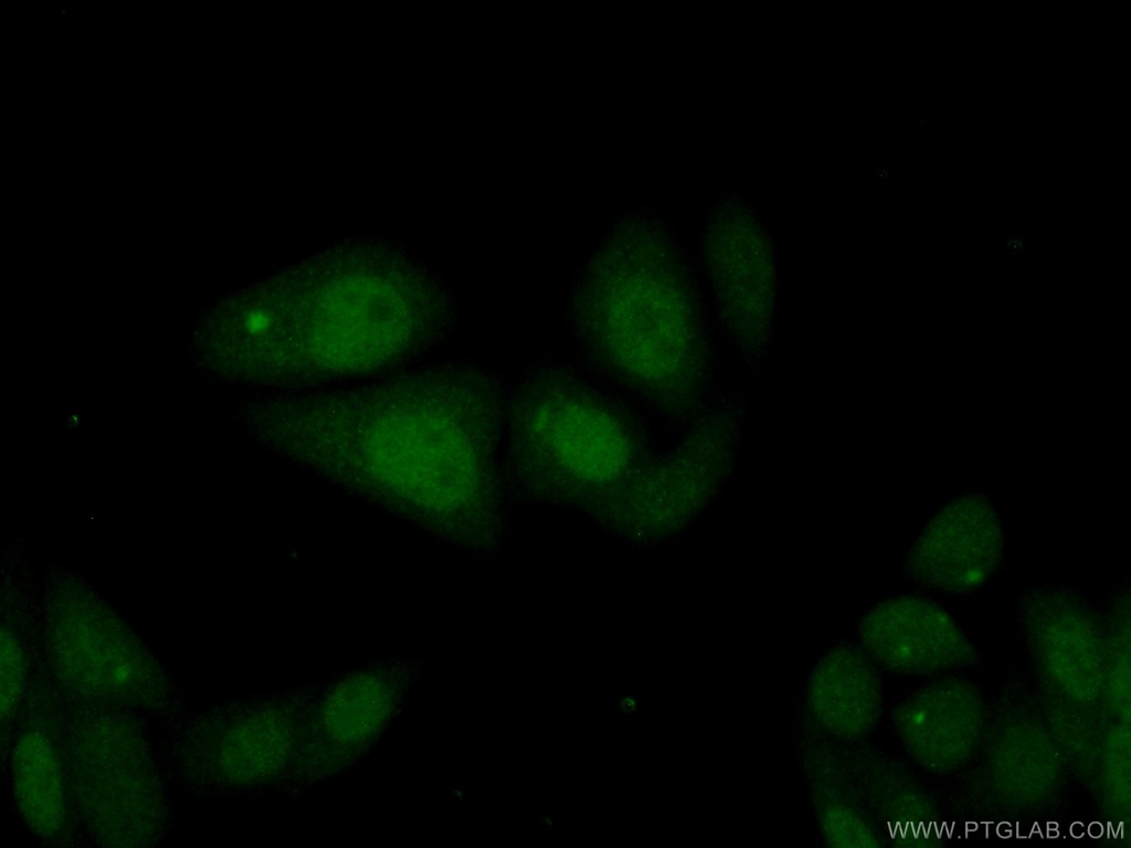 MCM10 Polyclonal antibody