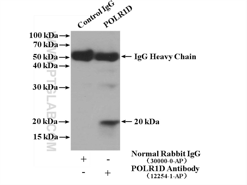 POLR1D Polyclonal antibody