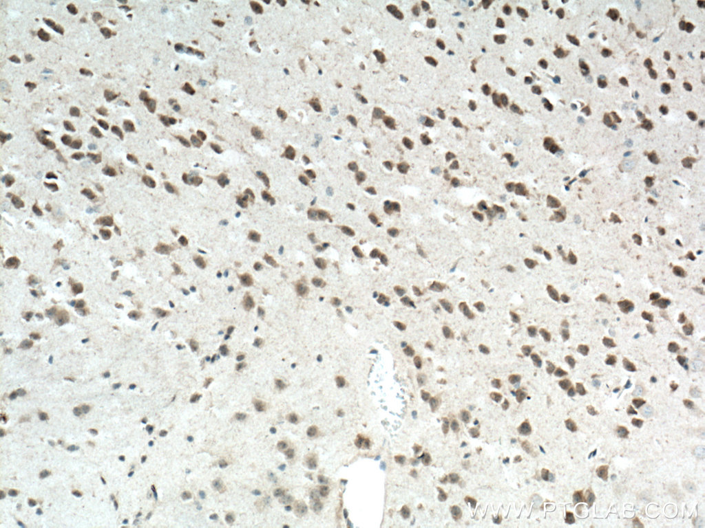 NLRP1 Polyclonal antibody