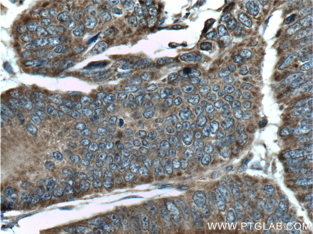 MTHFD2 Polyclonal antibody