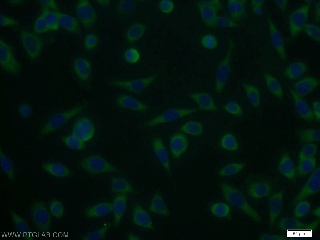 UCK1 Polyclonal antibody