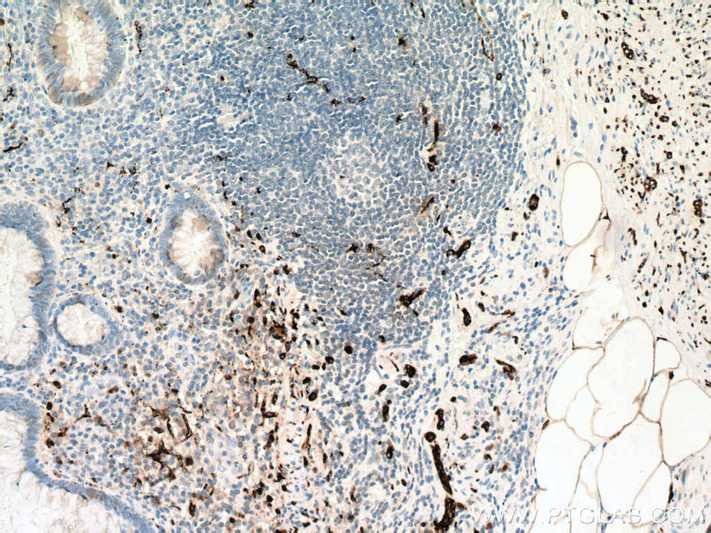 Calretinin Polyclonal antibody
