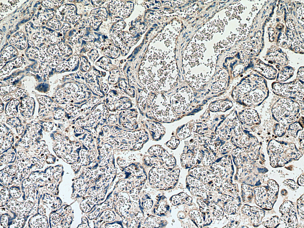 PLAC8 Polyclonal antibody
