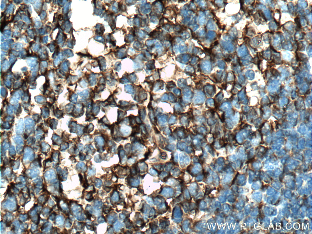 Clusterin Polyclonal antibody