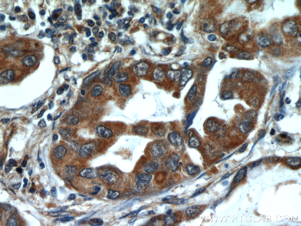 ALKBH3 Polyclonal antibody