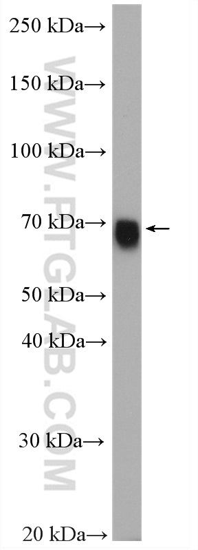 GATAD2A Polyclonal antibody