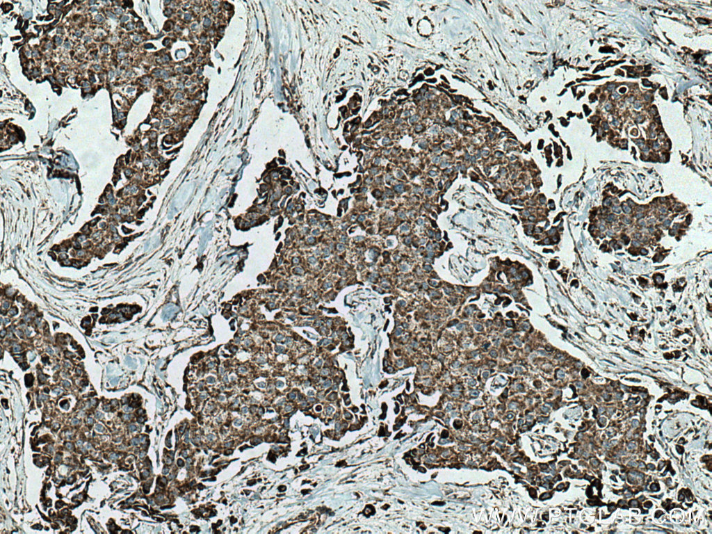 SFXN1 Polyclonal antibody