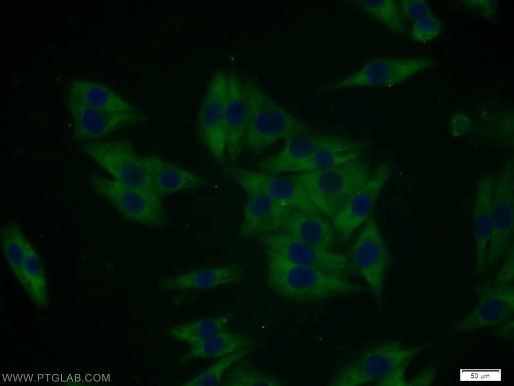 MTMR8 Polyclonal antibody