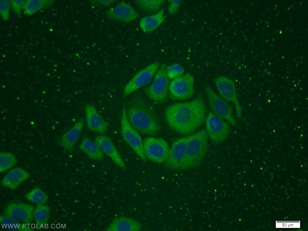 ITGB1BP1 Polyclonal antibody