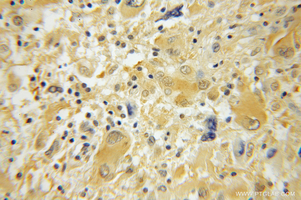 ACYP2 Polyclonal antibody