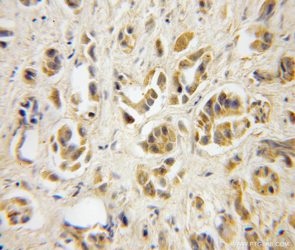 TBCA Polyclonal antibody