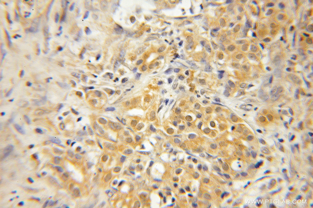 GNPDA1 Polyclonal antibody