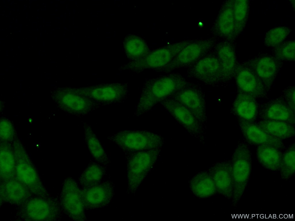 KIN17 Polyclonal antibody