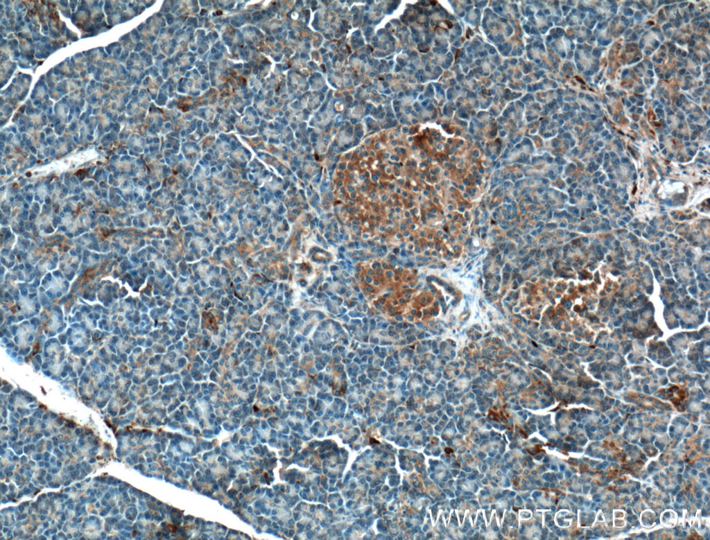 CRB3 Polyclonal antibody