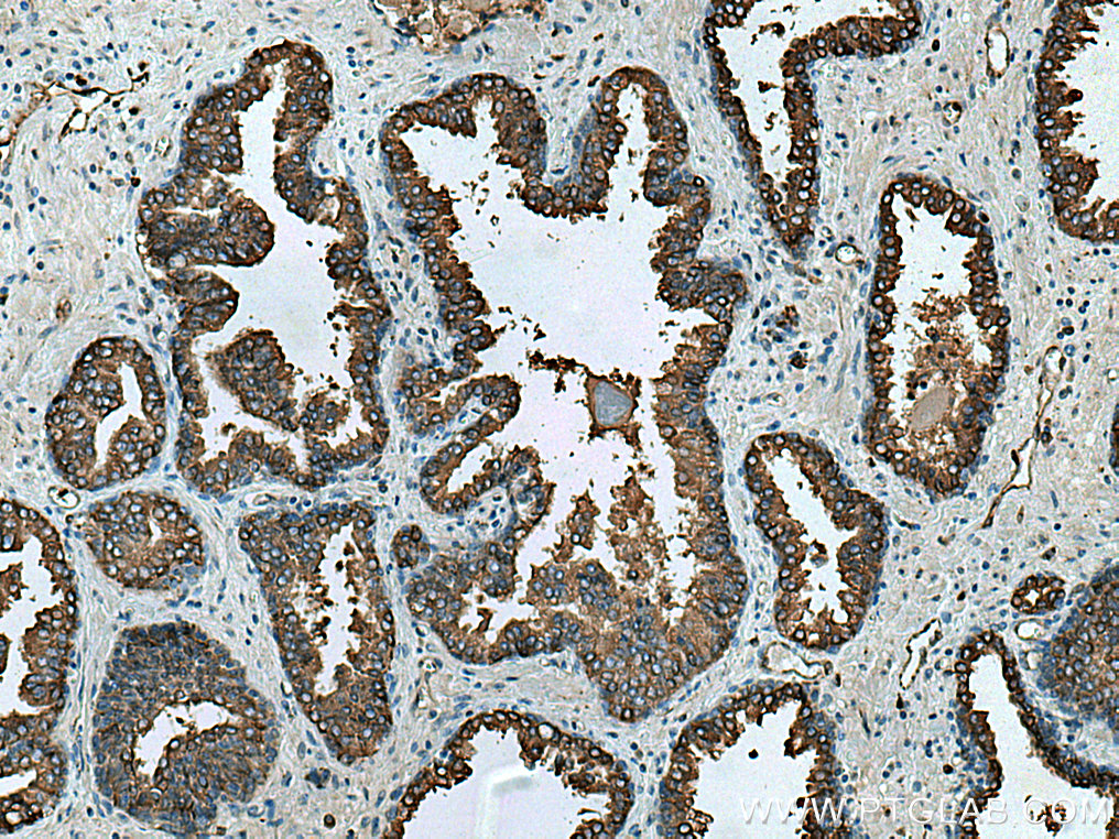 RAB3D Polyclonal antibody