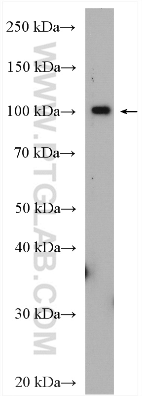 SCYL2 Polyclonal antibody