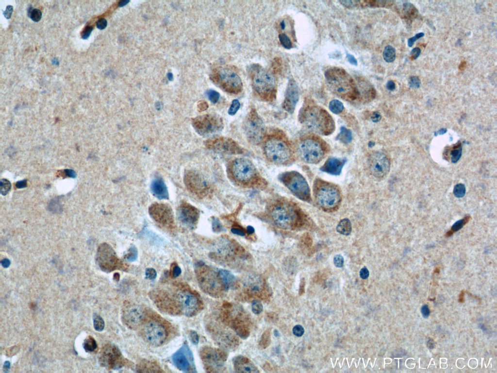 TWSG1 Polyclonal antibody
