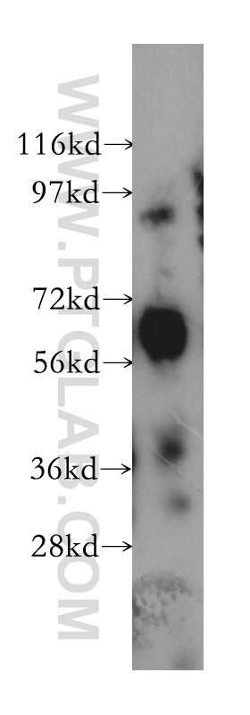 ARSG Polyclonal antibody