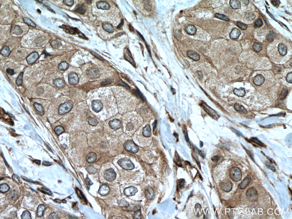 NUP98-NUP96 Polyclonal antibody