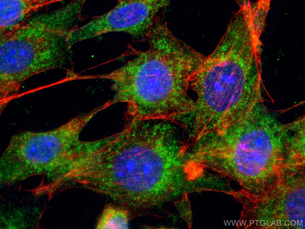 TAK1 Polyclonal antibody