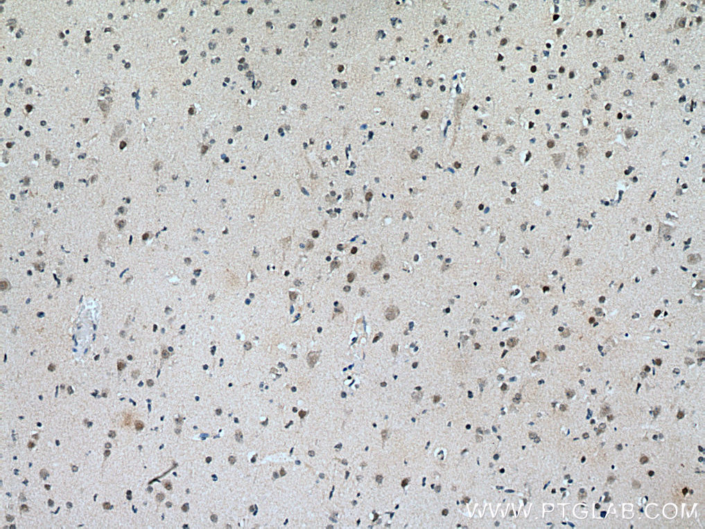 ASH2L Polyclonal antibody