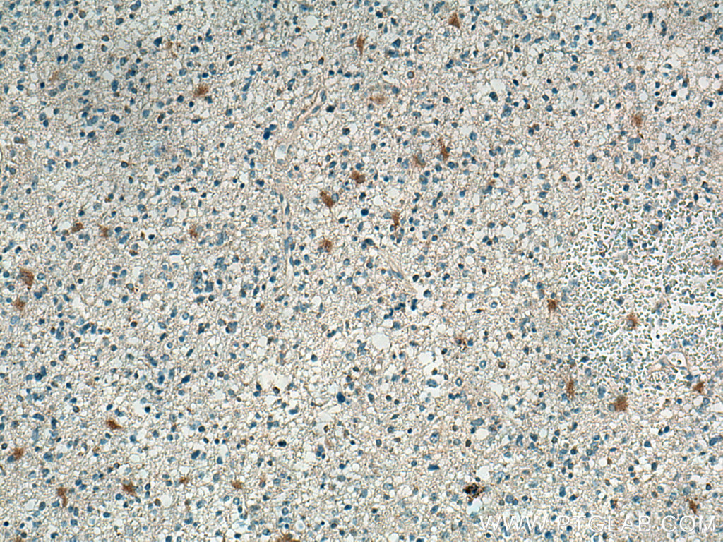 CXCL1 Polyclonal antibody