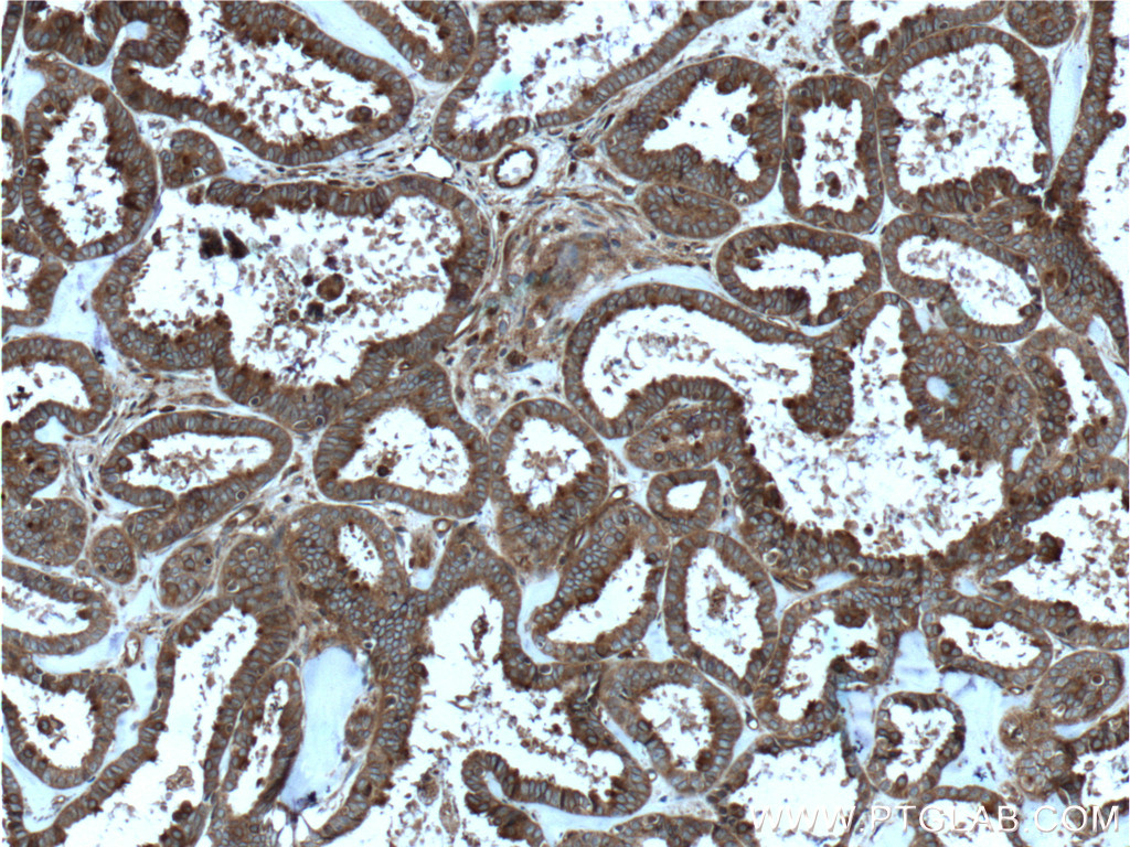 RALB Polyclonal antibody