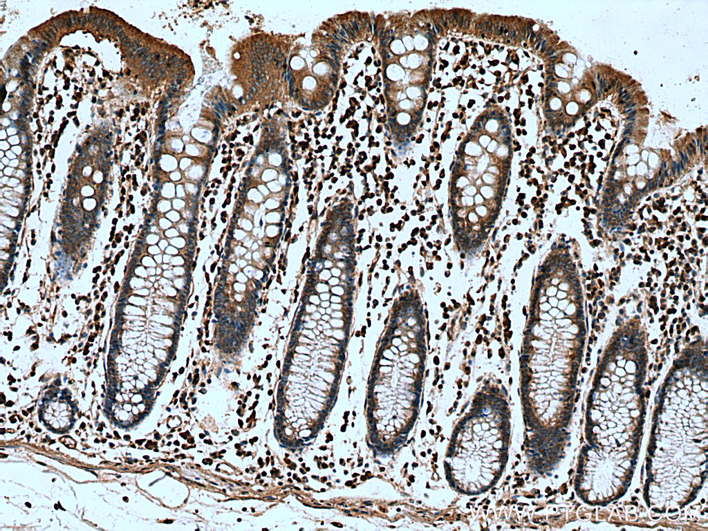 AKAP10 Polyclonal antibody
