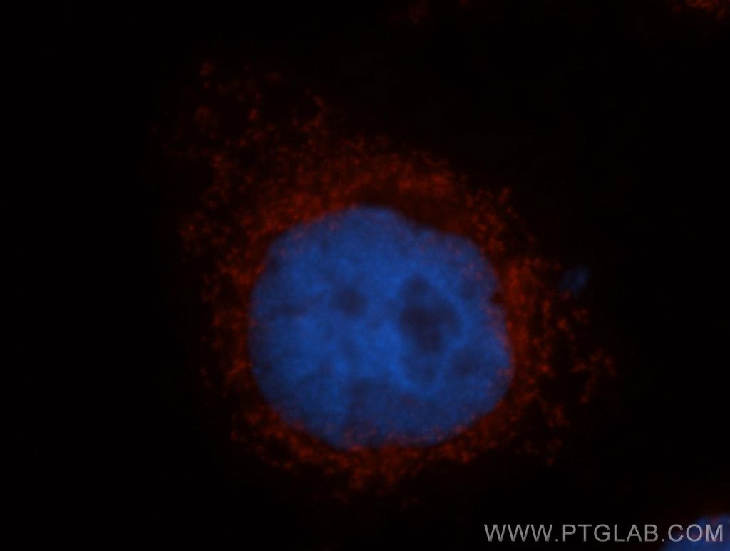 MRRF Polyclonal antibody