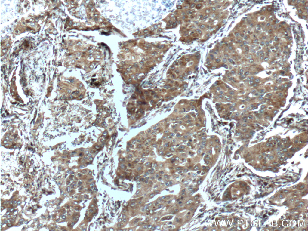 CCNDBP1 Polyclonal antibody