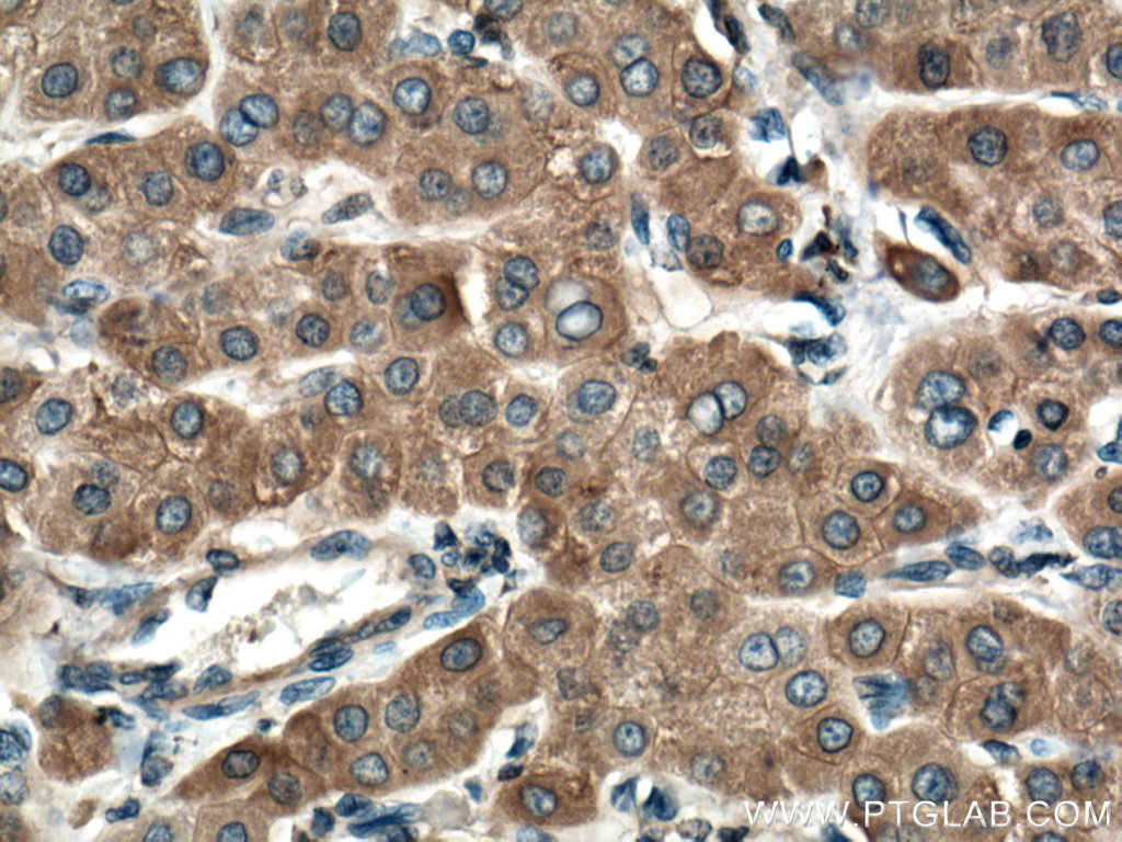 Cytochrome b5 Polyclonal antibody