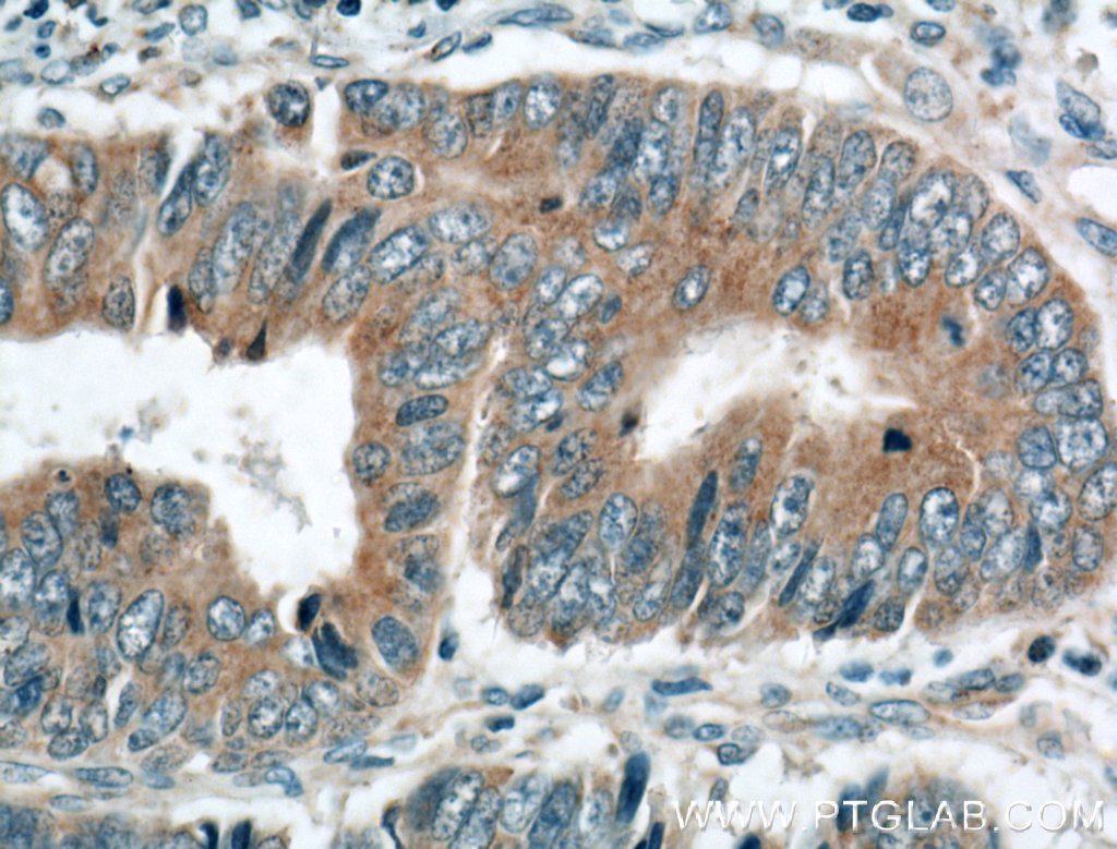 TSKU Polyclonal antibody