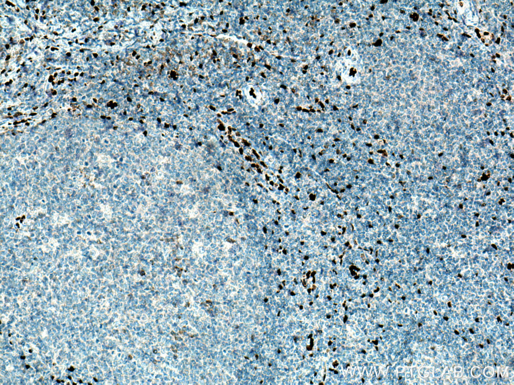 IL-33 Polyclonal antibody