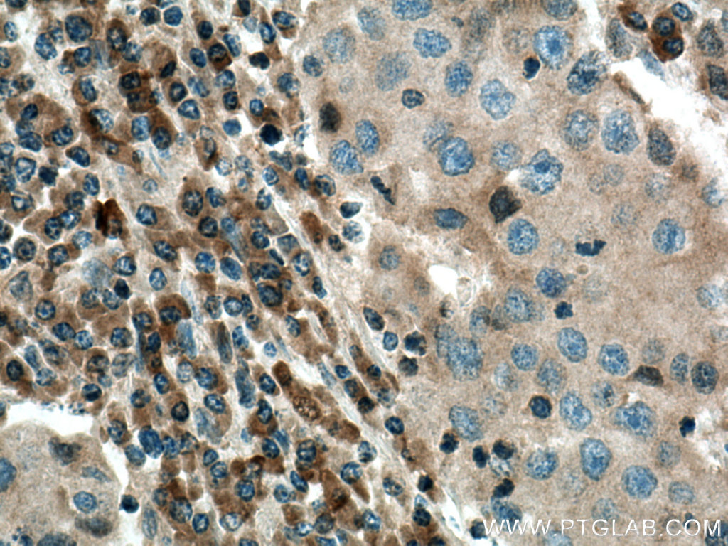 COX2/ Cyclooxygenase 2/ PTGS2 Polyclonal antibody