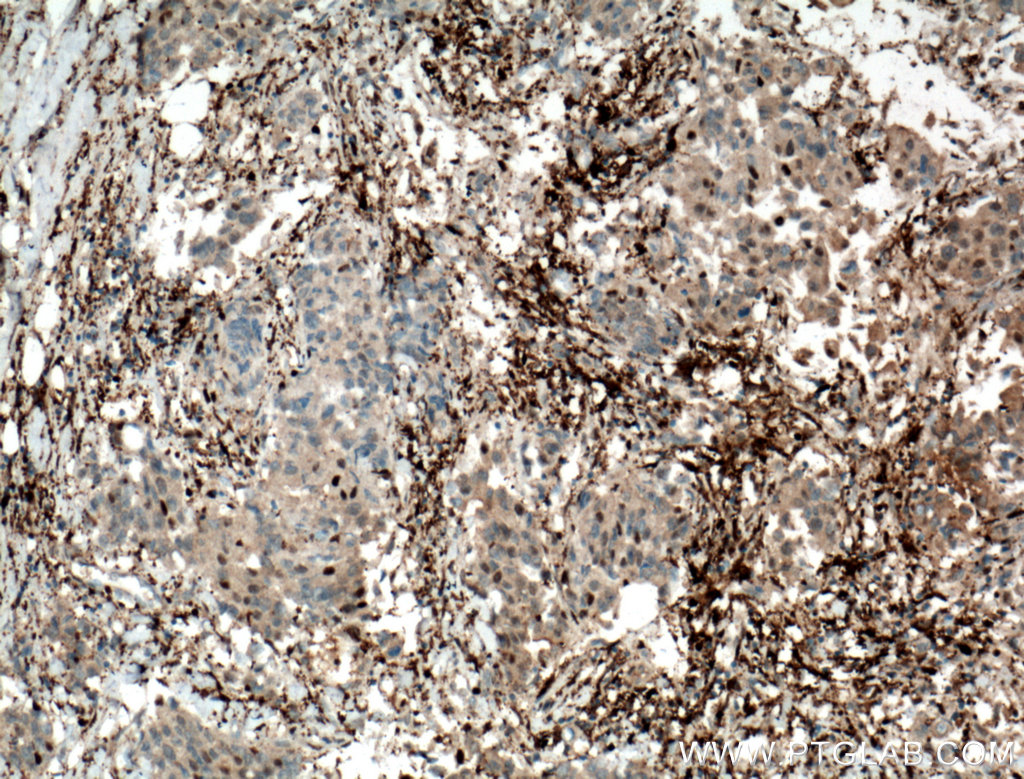 PD-ECGF Polyclonal antibody