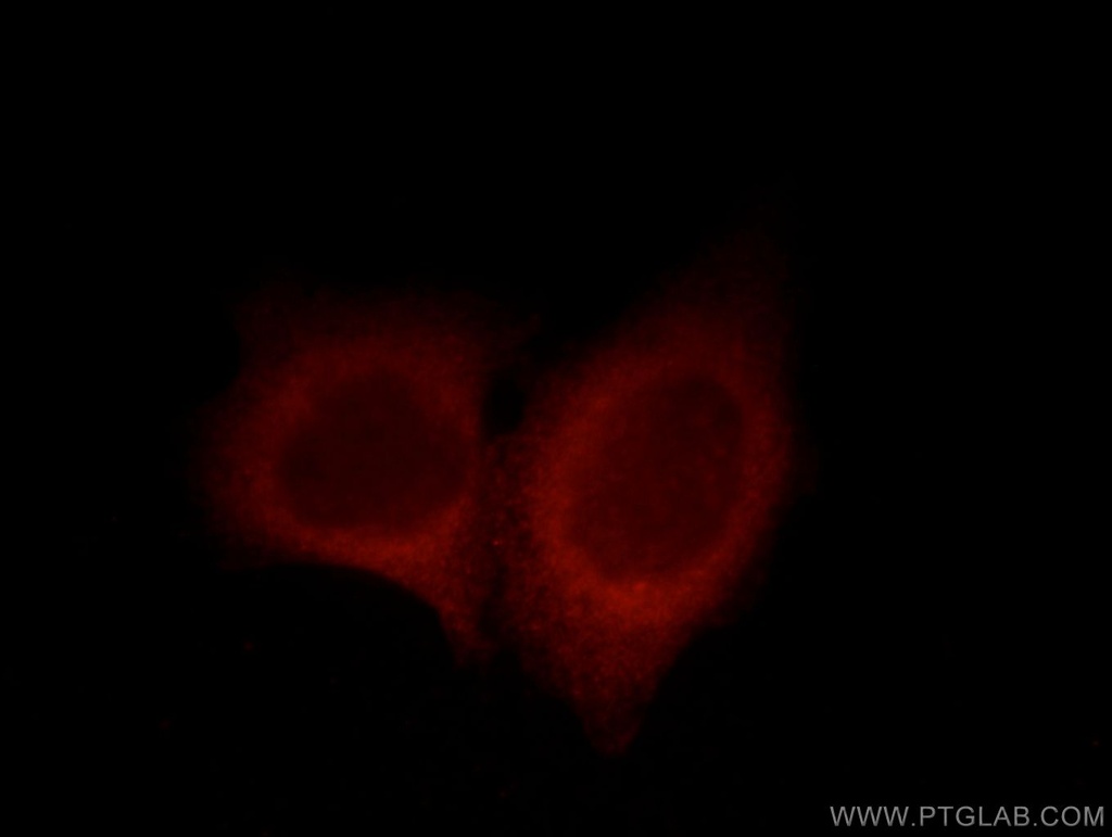 UBAP1 Polyclonal antibody
